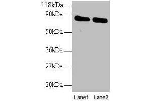 Western blot All lanes: OTUB1 antibody at 2 μg/mL Lane 1: EC109 whole cell lysate Lane 2: 293T whole cell lysate Secondary Goat polyclonal to rabbit IgG at 1/15000 dilution Predicted band size: 32, 36 kDa Observed band size: 80 kDa