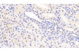 Detection of SOST in Human Kidney Tissue using Polyclonal Antibody to Sclerostin (SOST)
