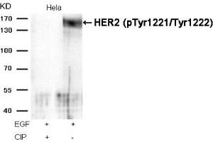 Western blot analysis of extracts from Hela cells, treated with EGF or calf intestinal phosphatase (CIP), using HER2 (Phospho-Tyr1221/Tyr1222) Antibody.