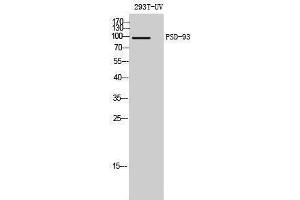 Western Blotting (WB) image for anti-Discs, Large Homolog 2 (DLG2) (Internal Region) antibody (ABIN3186576) (DLG2 anticorps  (Internal Region))