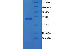 SDS-PAGE (SDS) image for Ubiquitin-Conjugating Enzyme E2D 3 (UBE2D3) (AA 1-147), (full length) protein (His-SUMO Tag) (ABIN5710584)