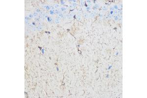 Immunohistochemistry of paraffin-embedded Mouse brain using S100B Rabbit pAb (ABIN3021047, ABIN3021048, ABIN3021049, ABIN1513496 and ABIN6213928) at dilution of 1:100 (40x lens). (S100B anticorps  (AA 1-92))