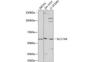 Western blot analysis of extracts of various cell lines, using SLC17 Polyclonal Antibody (ABIN7270407) at 1:1000 dilution. (Solute Carrier Family 17 (Vesicular Glutamate Transporter), Member 6 (SLC17A6) (C-Term) anticorps)