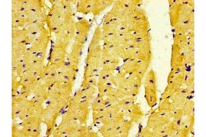 IHC image of ABIN7160623 diluted at 1:500 and staining in paraffin-embedded human heart tissue performed on a Leica BondTM system.