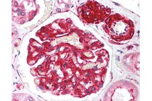 Image no. 1 for anti-Telomeric Repeat Binding Factor 2, Interacting Protein (TERF2IP) (AA 2406-2419) antibody (ABIN302914)