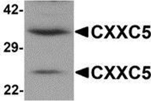 Western blot analysis of CXXC5 in human brain tissue lysate with CXXC5 antibody at 1 μg/ml. (CXXC5 anticorps  (N-Term))