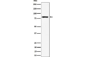 Western blot analysis of LTK expression in Raji cell lysate.