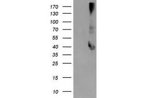 Western Blotting (WB) image for anti-Microtubule-Associated Protein, RP/EB Family, Member 2 (MAPRE2) antibody (ABIN1499318) (MAPRE2 anticorps)