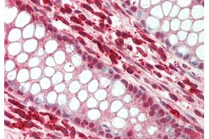 Rabbit Anti-Snai3 antibody Catalog Number: ARP37207 Formalin Fixed Paraffin Embedded Tissue: Human Colon Primary antibody Concentration: 1:200 Secondary Antibody: Donkey anti-Rabbit-Cy3 Secondary Antibody Concentration: 1:200 Magnification: 20x Exposure Time: 0.