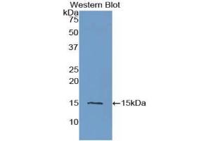 Detection of Recombinant CST3, Human using Polyclonal Antibody to Cystatin C (Cys-C) (CST3 anticorps  (AA 27-146))
