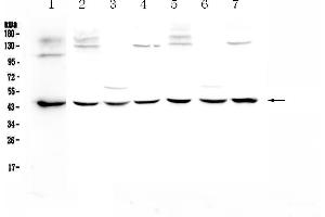 Western blot analysis of WWOX using anti-WWOX antibody . (WWOX anticorps  (AA 1-245))