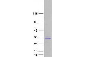 Validation with Western Blot