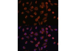 Immunofluorescence analysis of L929 cells using NDUF antibody (ABIN7268806) at dilution of 1:100. (NDUFAF2 anticorps  (AA 1-169))