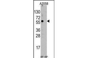 Western blot analysis of anti-ST13 Antibody (N-term) (ABIN390183 and ABIN2840674) pre-incubated with and without blocking peptide (BP6247a) in  cell line lysate. (HSC70 Interacting Protein HIP anticorps  (AA 50-80))
