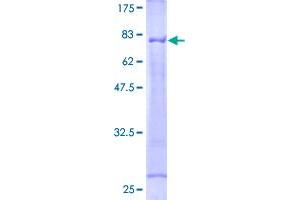 Image no. 1 for Tumor Necrosis Factor Receptor Superfamily, Member 1A (TNFRSF1A) (AA 1-455) protein (GST tag) (ABIN1323177)