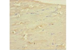 Immunohistochemistry of paraffin-embedded human skeletal muscle tissue using ABIN7159662 at dilution of 1:100 (WDR77 anticorps  (AA 1-312))