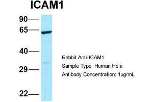 Host: Rabbit  Target Name: ICAM1  Sample Tissue: Human Hela  Antibody Dilution: 1.
