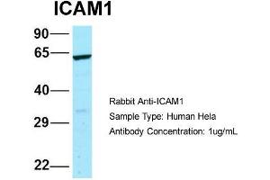 Host: Rabbit  Target Name: ICAM1  Sample Tissue: Human Hela  Antibody Dilution: 1. (ICAM1 anticorps  (N-Term))