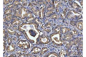IHC analysis of TOLLIP using anti-TOLLIP antibody (ABIN7599202). (TOLLIP anticorps  (AA 1-274))