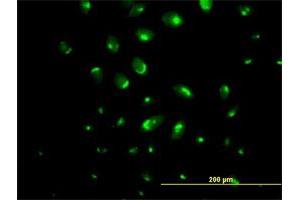 Immunofluorescence of purified MaxPab antibody to ATP2C1 on HeLa cell.
