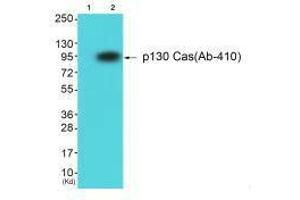 Western blot analysis of extracts from HuvEc cells using p130 Cas (Ab-410) antibody.