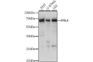 Western blot analysis of extracts of various cell lines, using PPIL4 antibody (ABIN7269212) at 1:1000 dilution. (PPIL4 anticorps  (AA 301-492))