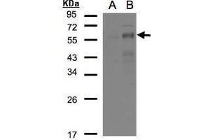 WB Image Western Blot analysis of EGR2 expression in transfected 293T cell line by EGR2 polyclonal antibody. (EGR2 anticorps)