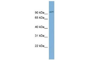 WB Suggested Anti-FBXO34 Antibody Titration: 0. (FBXO34 anticorps  (Middle Region))