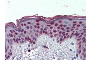 IHC Image of AP23070PU-N Human Skin: Formalin-Fixed, Paraffin-Embedded (FFPE) (HMGA1 anticorps  (Internal Region))
