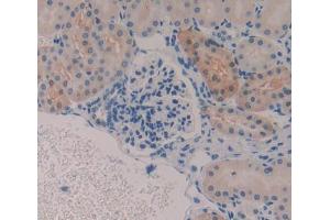 IHC-P analysis of Kidney tissue, with DAB staining. (GSTa2 anticorps  (AA 1-222))