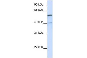 UGT1A6 antibody used at 1 ug/ml to detect target protein.