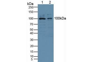 Detection of Recombinant cPLA2, Human using Polyclonal Antibody to Cytosolic Phospholipase A2 (PLA2G4) (PLA2G4A anticorps  (AA 563-749))
