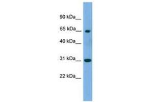 Image no. 1 for anti-Polynucleotide Kinase 3'-Phosphatase (PNKP) (AA 359-408) antibody (ABIN6744968) (PNKP anticorps  (AA 359-408))