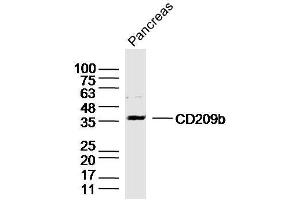 Pancreas lysates probed with DC-SIGNR1/CD209b Polyclonal Antibody, Unconjugated  at 1:300 dilution and 4˚C overnight incubation. (CD209b Antigen (CD209B) (AA 51-150) anticorps)
