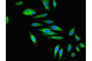 Immunofluorescent analysis of Hela cells using ABIN7176063 at dilution of 1:100 and Alexa Fluor 488-congugated AffiniPure Goat Anti-Rabbit IgG(H+L)