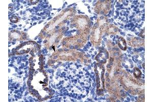 RGS13 antibody was used for immunohistochemistry at a concentration of 4-8 ug/ml to stain Epithelial cells of renal tubule (arrows) in Human Kidney. (RGS13 anticorps  (Middle Region))