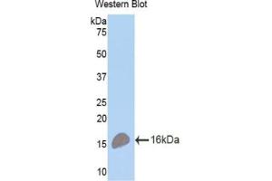 Detection of Recombinant TNFRSF17, Mouse using Polyclonal Antibody to Tumor Necrosis Factor Receptor Superfamily, Member 17 (TNFRSF17)