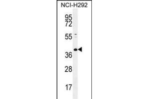 KCTD2 Antibody (C-term) (ABIN655466 and ABIN2844993) western blot analysis in NCI- cell line lysates (35 μg/lane). (KCTD2 anticorps  (C-Term))
