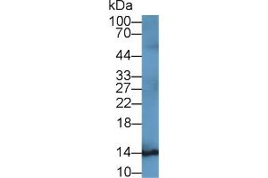Detection of S100B in Rat Cerebrum lysate using Monoclonal Antibody to S100 Calcium Binding Protein B (S100B) (S100B anticorps  (AA 1-92))