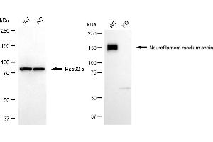 Western blotting analysis using neurofilament medium chain antibody (ABIN7800956). (Recombinant Neurofilament Medium Chain anticorps)
