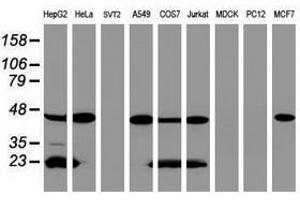 Image no. 4 for anti-Acyl-CoA Dehydrogenase, C-2 To C-3 Short Chain (Acads) (AA 34-260) antibody (ABIN1491430)