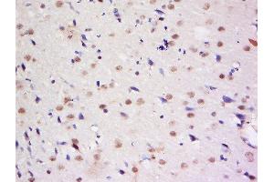 Formalin-fixed and paraffin embedded rat brain labeled with Anti-Dymeclin Polyclonal Antibody, Unconjugated  at 1:200 followed by conjugation to the secondary antibody and DAB staining. (Dymeclin anticorps  (AA 151-250))