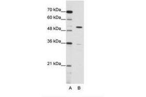 Image no. 1 for anti-Zinc Finger Protein 485 (ZNF485) (C-Term) antibody (ABIN6736173) (ZNF485 anticorps  (C-Term))