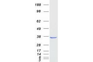 Validation with Western Blot