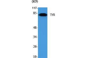 Western Blot (WB) analysis of specific cells using TYR Polyclonal Antibody. (TYR anticorps  (C-Term))