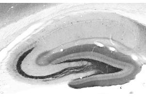 Adult rat hippocampus immunohistochemistry.