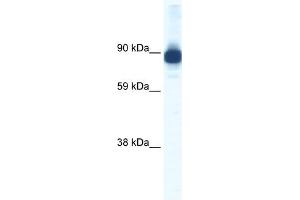 WB Suggested Anti-ACTN2 Antibody Titration:  0. (ACTN2 anticorps  (C-Term))