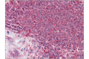 Formalin-Fixed, Paraffin-Embedded Human Spleen stained with Thrombospondin-1 antibody at 3. (Thrombospondin 1 anticorps  (N-Term))