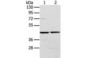 Western Blot analysis of Hepg2 and hela cell using RRAGA Polyclonal Antibody at dilution of 1:400 (RRAGA anticorps)