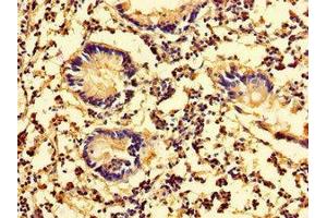 Immunohistochemistry of paraffin-embedded human appendix tissue using ABIN7157942 at dilution of 1:100 (Latexin anticorps  (AA 1-216))